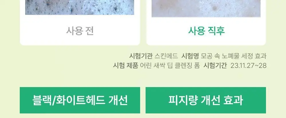 [블랙헤드개선] 수이스킨 어린 새싹 딥 클렌징 폼 150ml 상세페이지 12